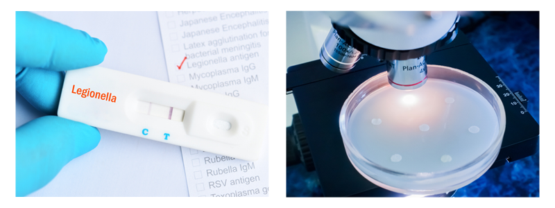 Legionella test